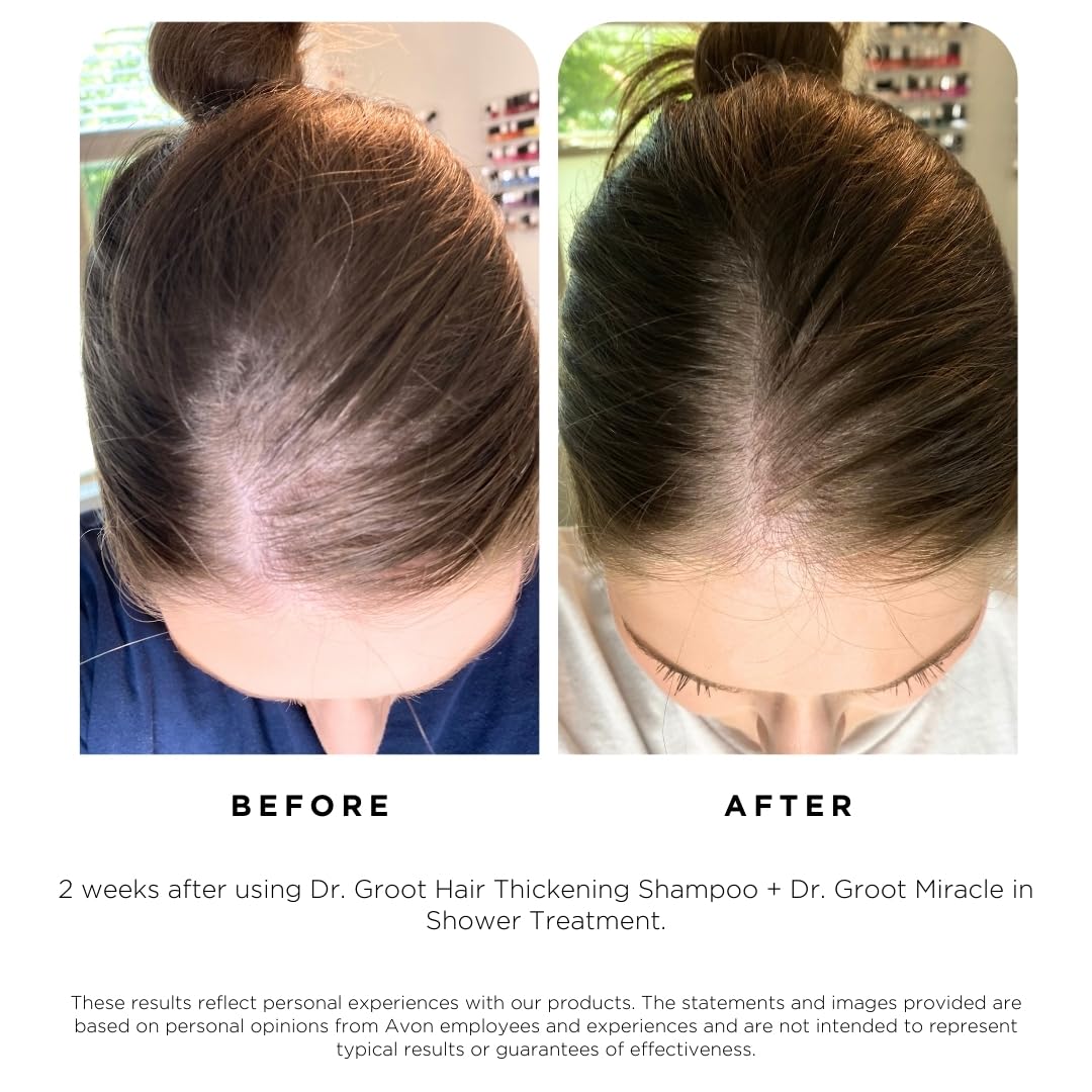 ✨SALE! ✨Buy two or more and get 15% OFF! 💥 At-Home & On-the-Go Solution for Hair Thinning