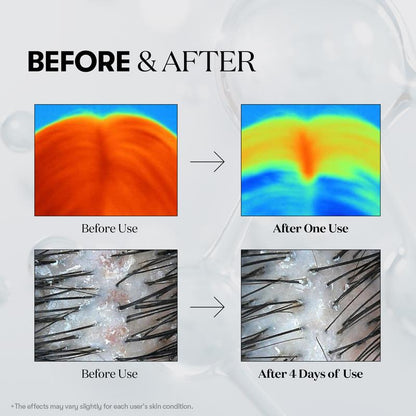 PDRN Reedle Shot Hair Ampoule Hair Growth Hair loss treatment ampoule serum